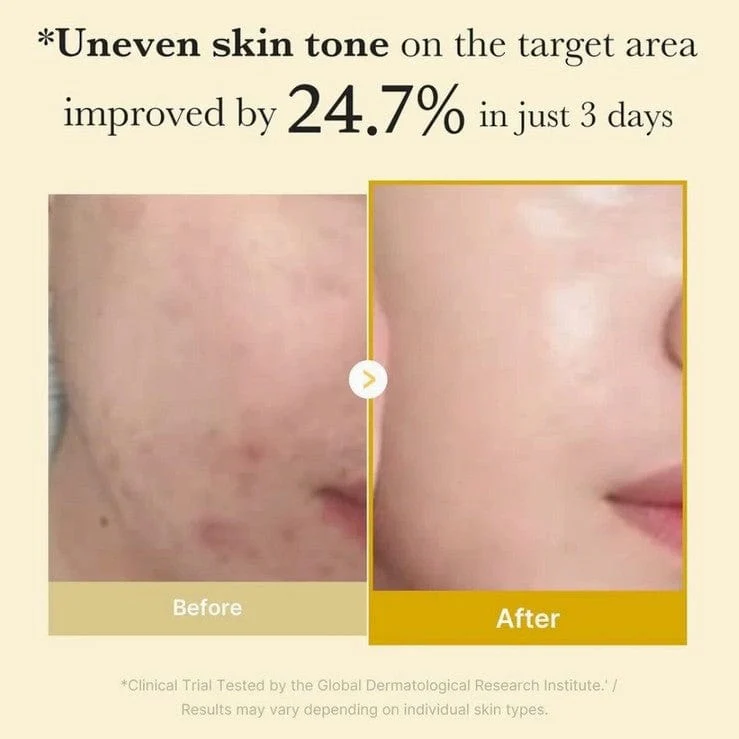 Medicube Kojic Acid Turmeric Night Wrapping Mask Results Before And After
