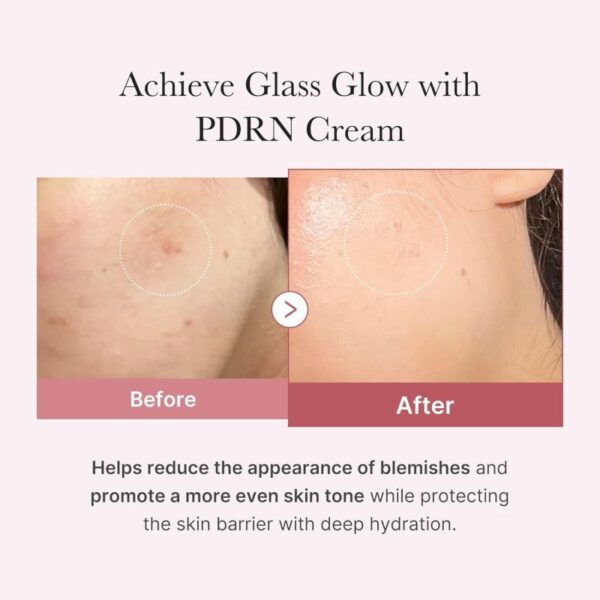 Medicube PDRN Pink Hyaluronic Moisturizing Cream 50мл